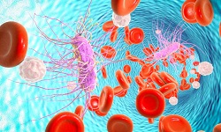 Bacteremia, Septicemia
